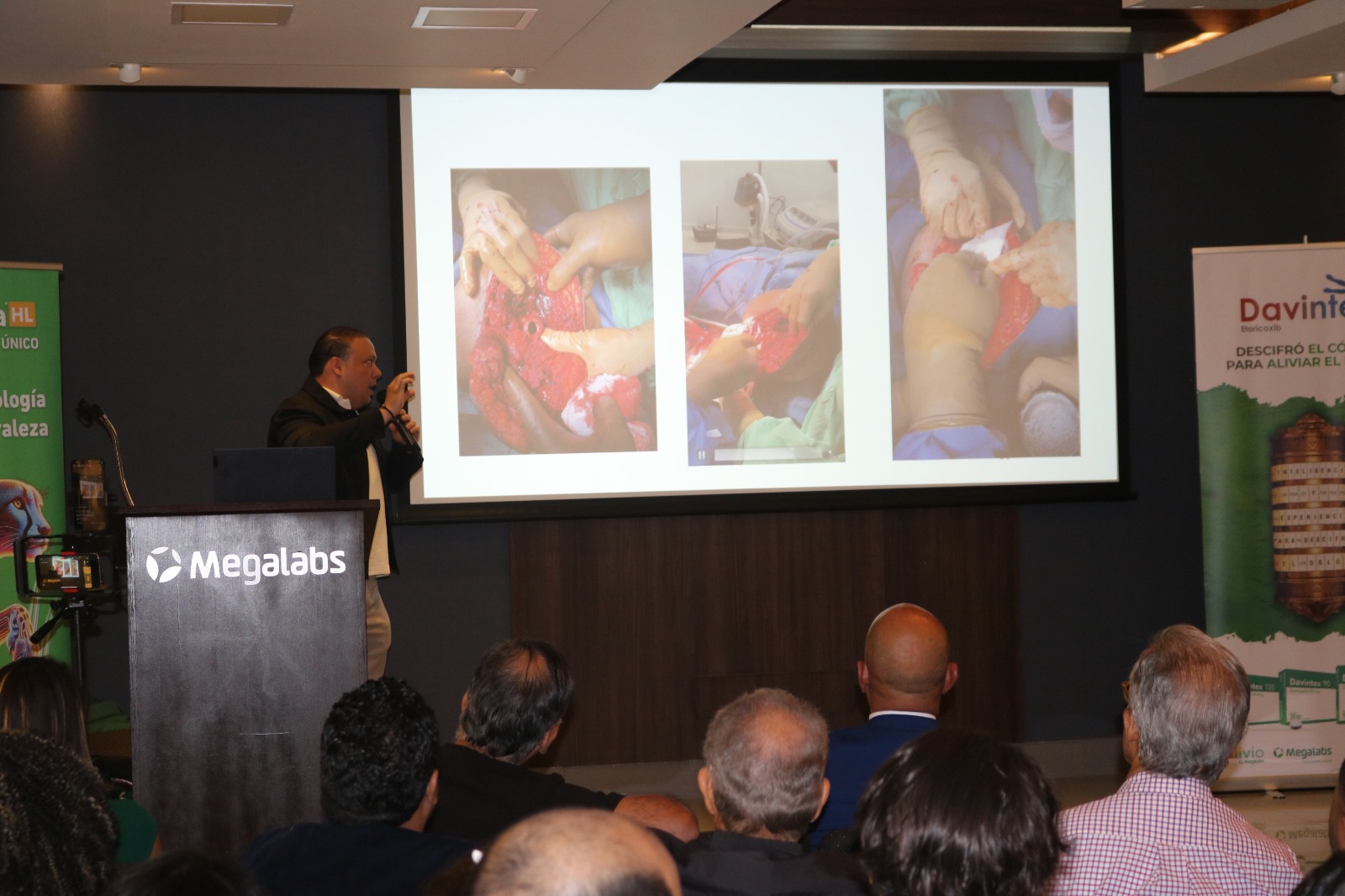 Diagnóstico y Clasificación de la Osteomielitis - Imagen 10